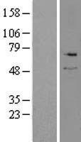 Serine Palmitoyltransferase (SPTLC2) Human Over-expression Lysates NM_004863