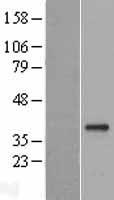 GDF15 Human Over-expression Lysates NM_004864