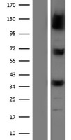 NPEPPS Human Over-expression Lysates NM_006310