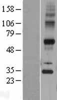 GPSN2 (TECR) Human Over-expression Lysates NM_138501
