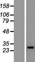 ls009527 gosr1 human over expression lysates nm 001007025 wb testing 1