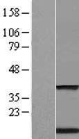 TMEM59 Human Over-expression Lysates NM_004872