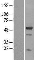 BAG5 Human Over-expression Lysates NM_004873