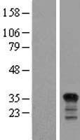 PIG3 (TP53I3) Human Over-expression Lysates NM_004881