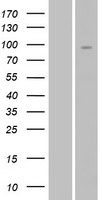 NRG2 Human Over-expression Lysates NM_013982