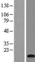 ATP6J (ATP6V1G1) Human Over-expression Lysates NM_004888