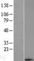 MRPL33 Human Over-expression Lysates NM_145330