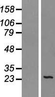 SEC22L1 (SEC22B) Human Over-expression Lysates NM_004892