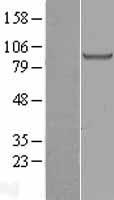 H6PD Human Over-expression Lysates NM_004285