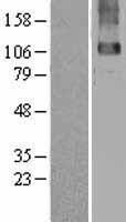 GABA B Receptor 2 (GABBR2) Human Over-expression Lysates NM_005458