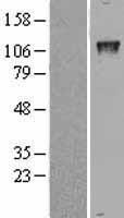 GTF2IRD1 Human Over-expression Lysates NM_016328