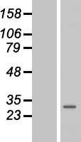 Membrin (GOSR2) Human Over-expression Lysates NM_001012511