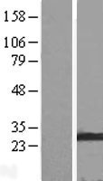 Membrin (GOSR2) Human Over-expression Lysates NM_004287