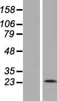 Membrin (GOSR2) Human Over-expression Lysates NM_054022