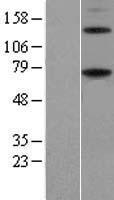 ls009583 entpd4 human over expression lysates nm 004901 wb testing 1
