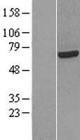 HCC1 (RBM39) Human Over-expression Lysates NM_184234