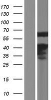 CREB5 Human Over-expression Lysates NM_182898