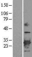 Peroxiredoxin 6 (PRDX6) Human Over-expression Lysates NM_004905