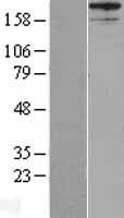 ls009590 akap12 human over expression lysates nm 144497 wb testing 2