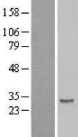 ls009592 ier2 human over expression lysates nm 004907 wb testing 1