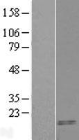CART (CARTPT) Human Over-expression Lysates NM_004291