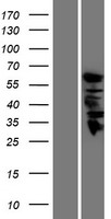 GDA Human Over-expression Lysates NM_004293