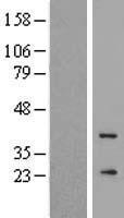 ls009626 gcap3 guca1c human over expression lysates nm 005459 wb testing 1