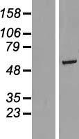 RGS6 Human Over-expression Lysates NM_004296