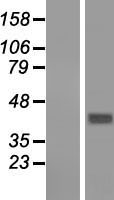 GNA14 Human Over-expression Lysates NM_004297