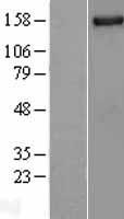 NUP155 Human Over-expression Lysates NM_153485