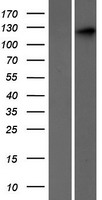SEC24C Human Over-expression Lysates NM_198597