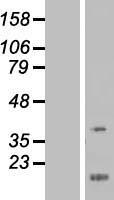 ls009638 fez1 human over expression lysates nm 022549 wb testing 2