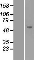 SOCS5 Human Over-expression Lysates NM_144949