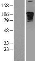 ls009659 pde4dip human over expression lysates nm 001002812 wb testing 1