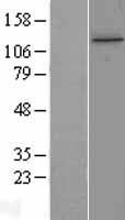 ls009675 tti1 human over expression lysates nm 014657 wb testing 1