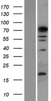 PHF14 Human Over-expression Lysates NM_014660