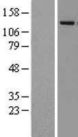 KDM4A Human Over-expression Lysates NM_014663