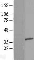 TTC35 (EMC2) Human Over-expression Lysates NM_014673