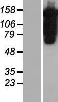Pumilio 1 (PUM1) Human Over-expression Lysates NM_014676