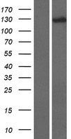 DHX34 Human Over-expression Lysates NM_014681