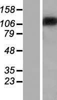 ST18 Human Over-expression Lysates NM_014682