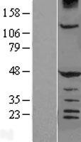 HERPUD1 Human Over-expression Lysates NM_001010989