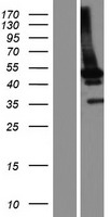 HERPUD1 Human Over-expression Lysates NM_001010990