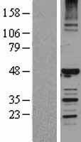 HERPUD1 Human Over-expression Lysates NM_014685