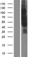 ls009710 garre1 human over expression lysates nm 014686 wb testing 1