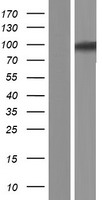 USP6NL Human Over-expression Lysates NM_001080491