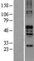 CAPON (NOS1AP) Human Over-expression Lysates NM_014697