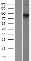 Semaphorin 3E (SEMA3E) Human Over-expression Lysates NM_012431