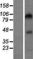 CEP104 Human Over-expression Lysates NM_014704