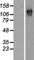 SART3 Human Over-expression Lysates NM_014706